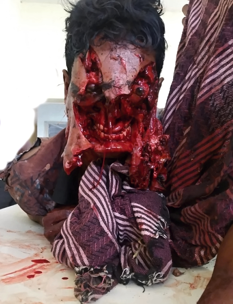 JESUS: Random Corpses