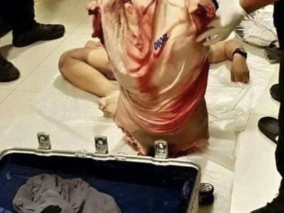 Woman found dismembered