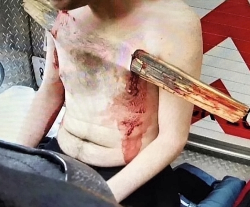 Various injuries and illnesses #1