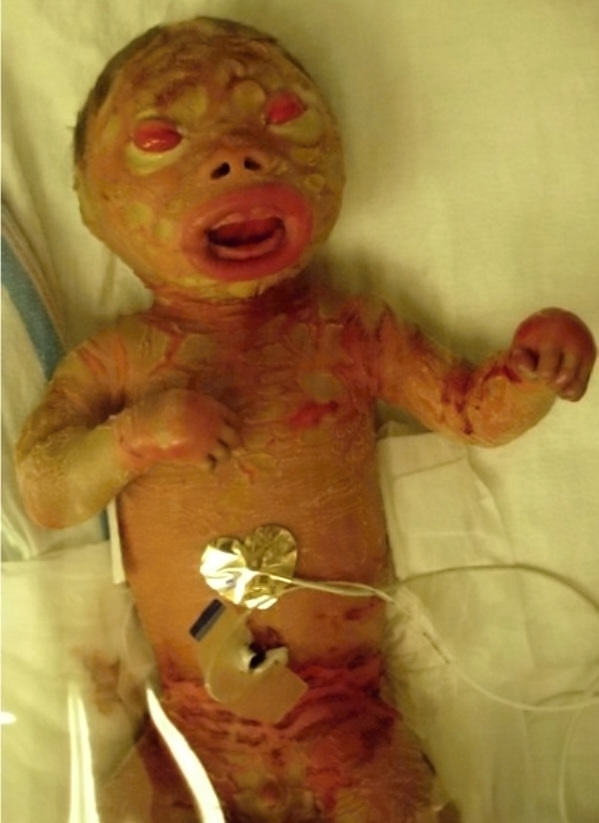 Various injuries and illnesses #1