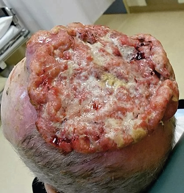 Various injuries and illnesses #1