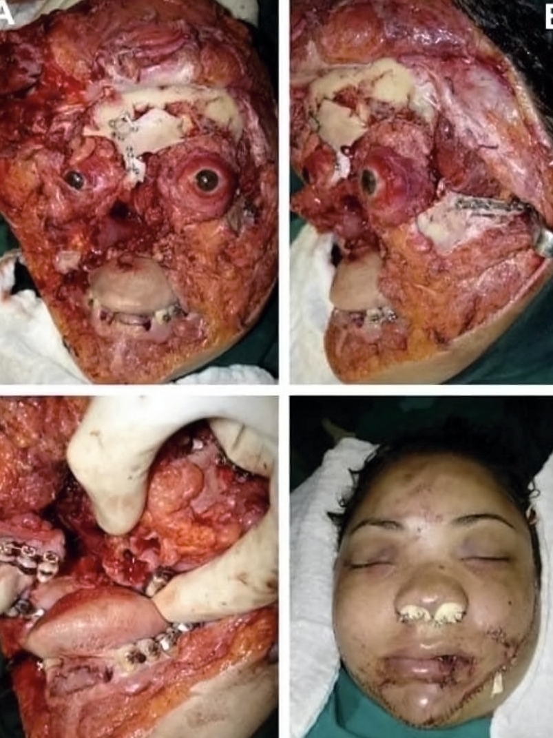 Various injuries and illnesses #1