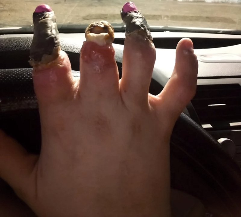 Various injuries and illnesses #1