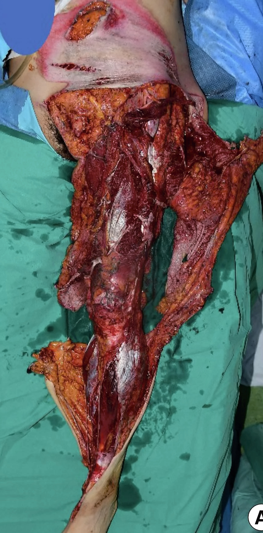 Various injuries and illnesses #1