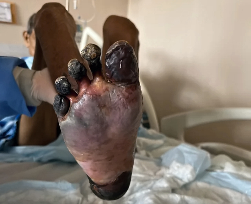 Various injuries and illnesses #1