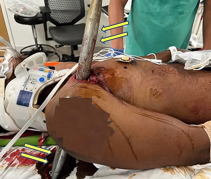 Various injuries and illnesses #1