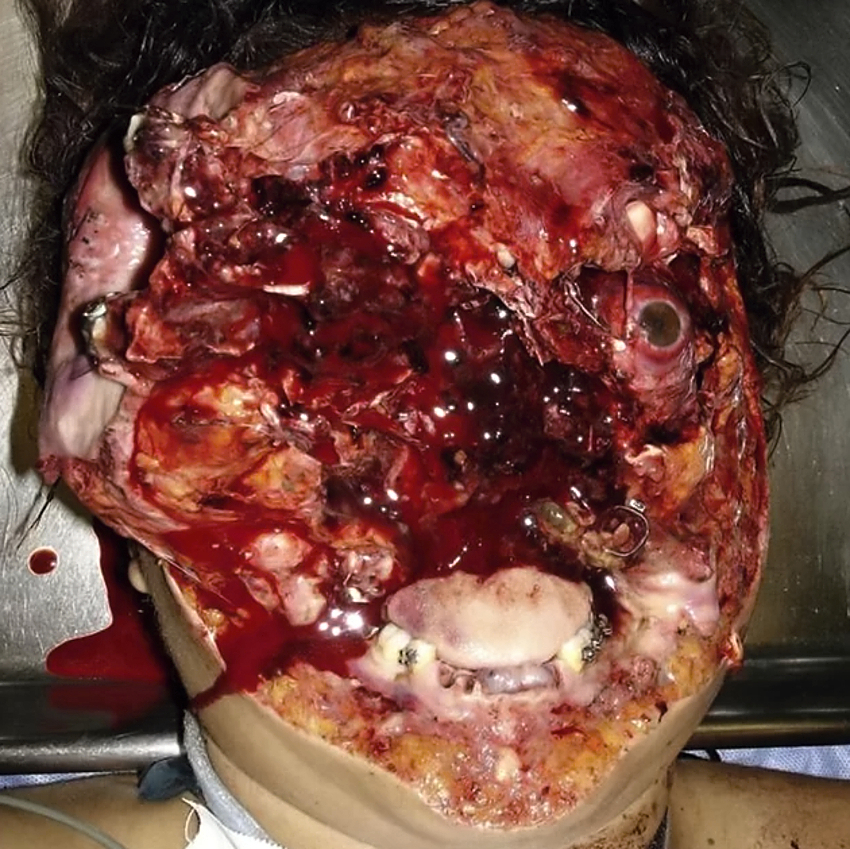 Various injuries and illnesses #1