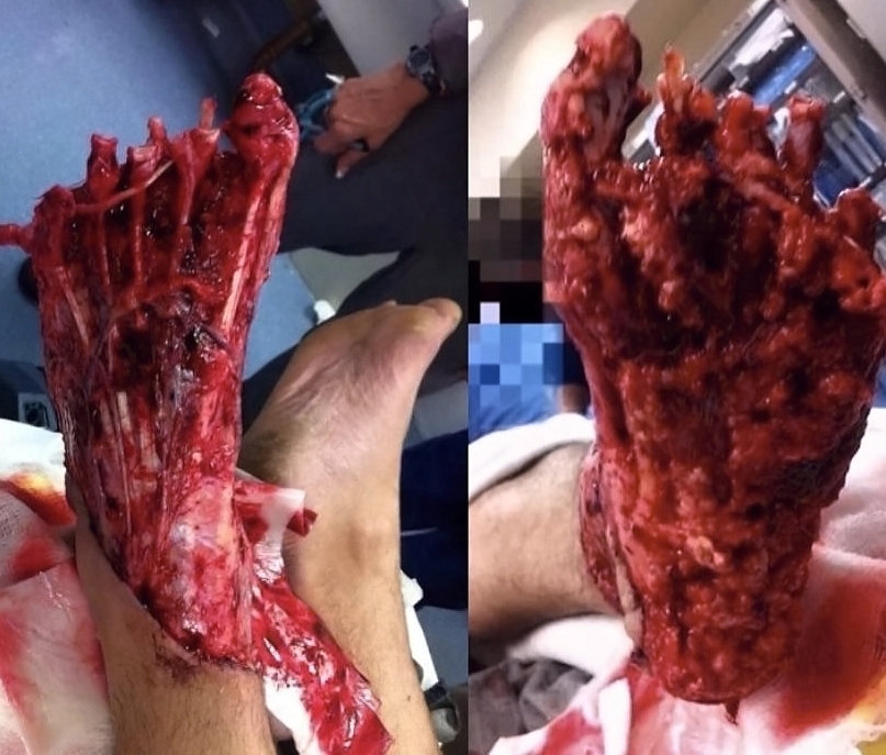 Various injuries and illnesses #1