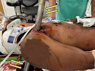 Various horrific injuries and illnesses