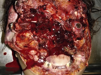 Various horrific injuries and illnesses