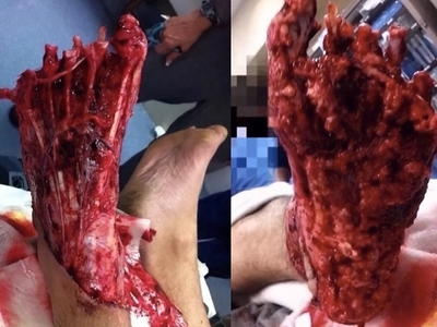 Various injuries and illnesses #1