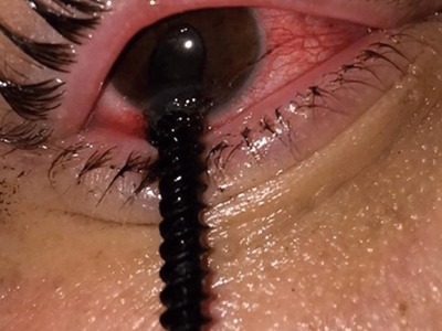 Various injuries and illnesses #2