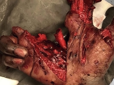 Various injuries and illnesses #2