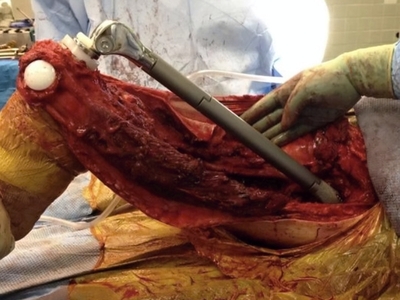 Various injuries and illnesses #2