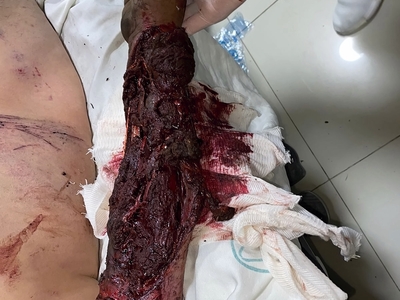 Various injuries and illnesses #2