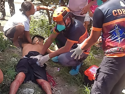 Hungry wife stabs drunk husband in the ass