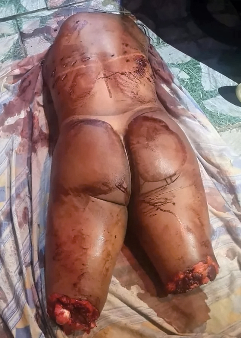 Trans woman before and after a date with a client in Brazil