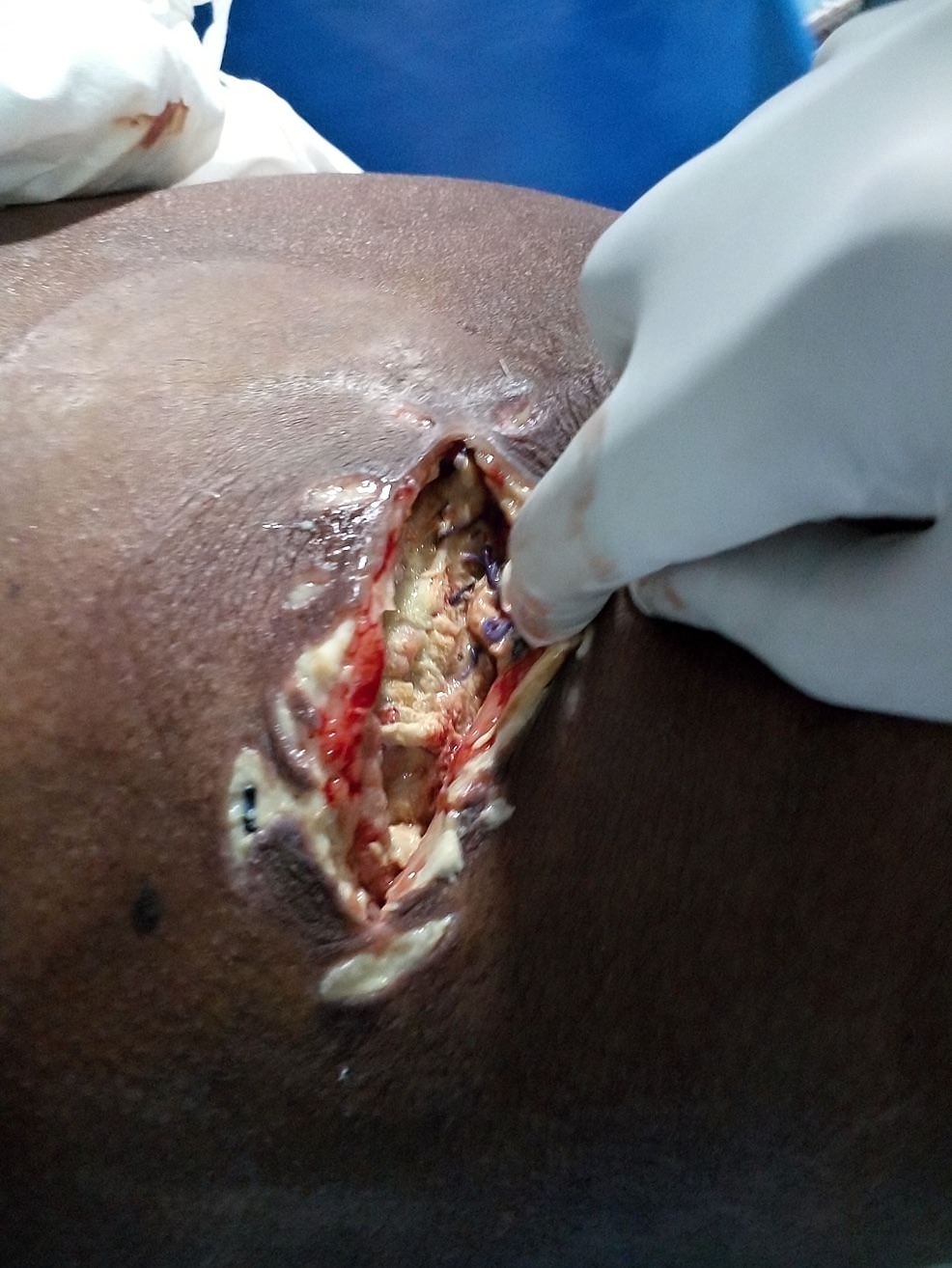 Various injuries and illnesses #IV