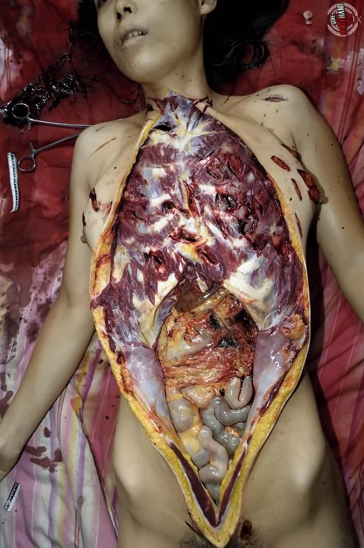 Various injuries and illnesses #IV