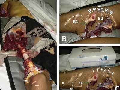 Various injuries and illnesses #IV