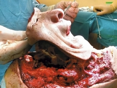 Various injuries and illnesses #IV