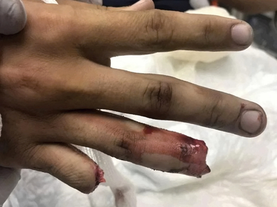 Various injuries and illnesses #IV