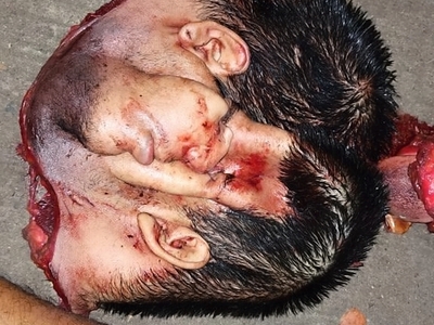 Various injuries and illnesses #IV