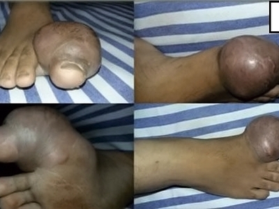 Various injuries and illnesses #IV