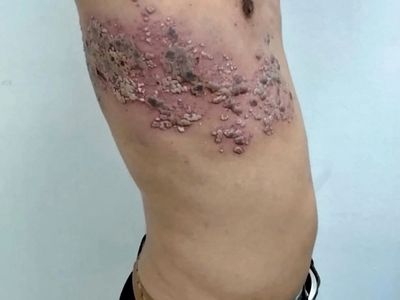 Various injuries and illnesses #IV