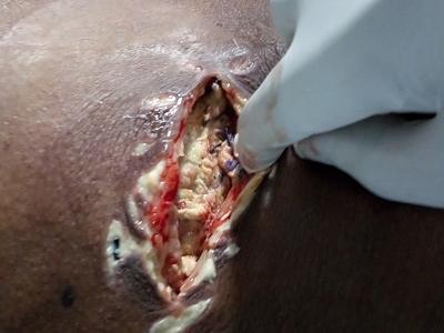 Various injuries and illnesses #IV