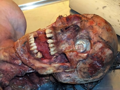 Various injuries and illnesses #IV