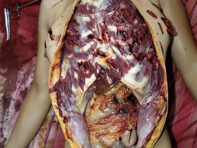 Various injuries and illnesses #IV