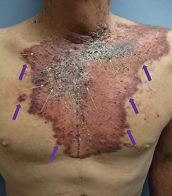 Death, Illness, Injury, Healing #1