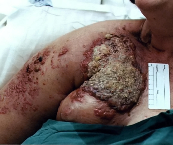 Death, Illness, Injury, Healing #1