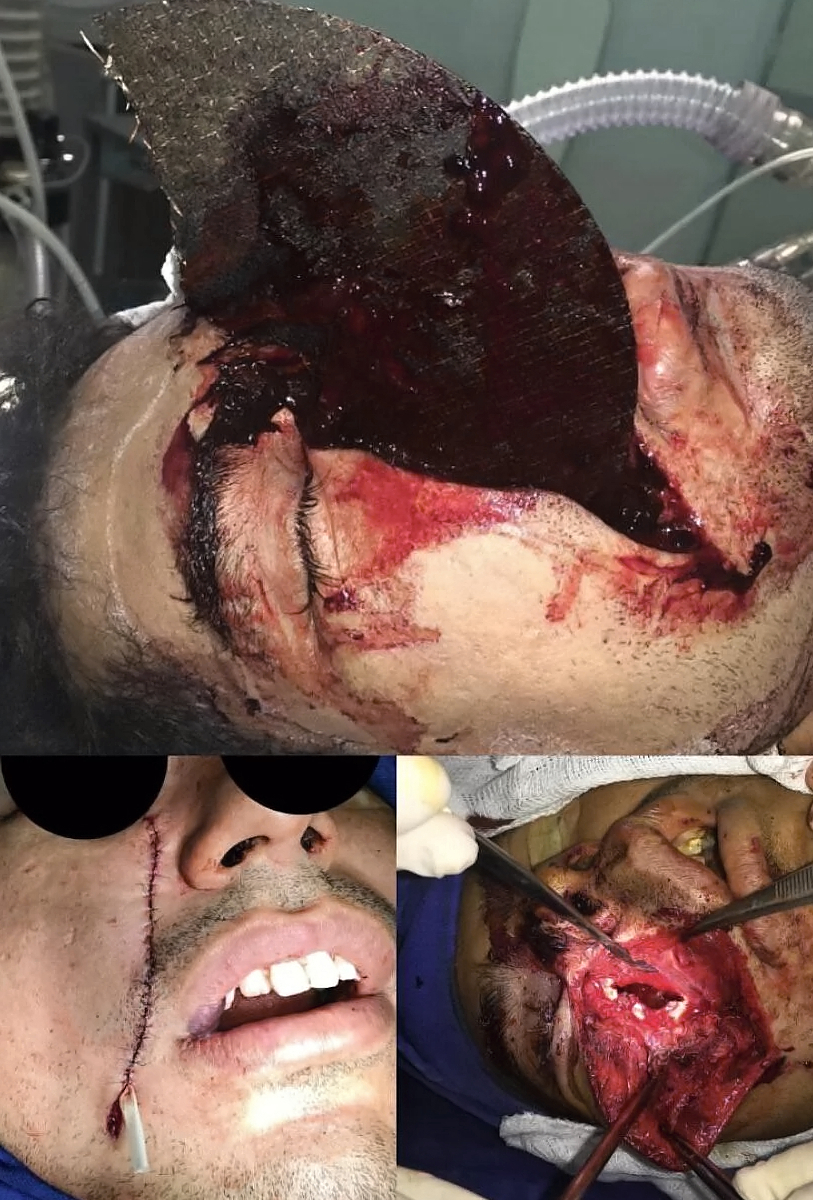 Death, Illness, Injury, Healing #1