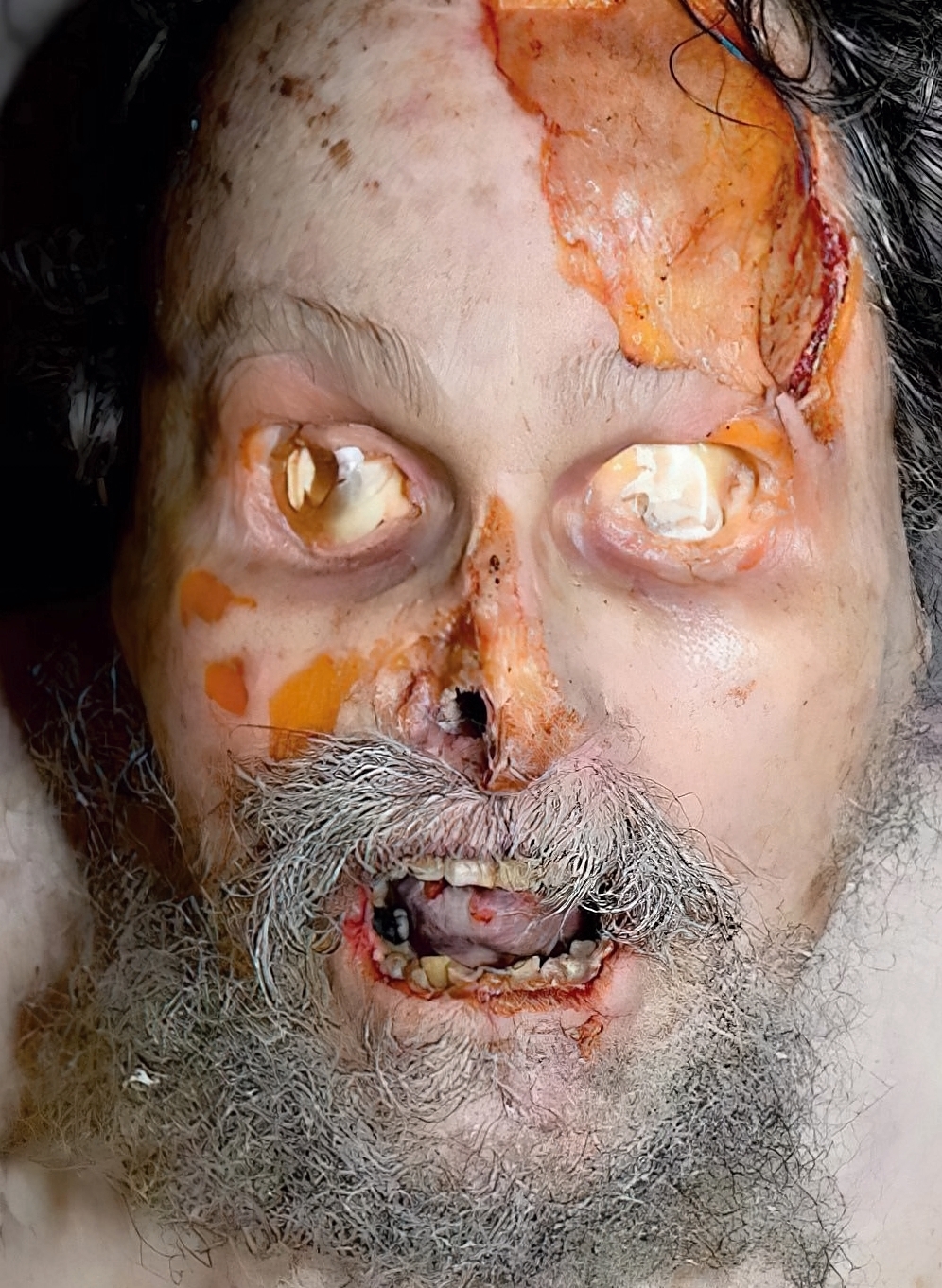 Death, Illness, Injury, Healing #1