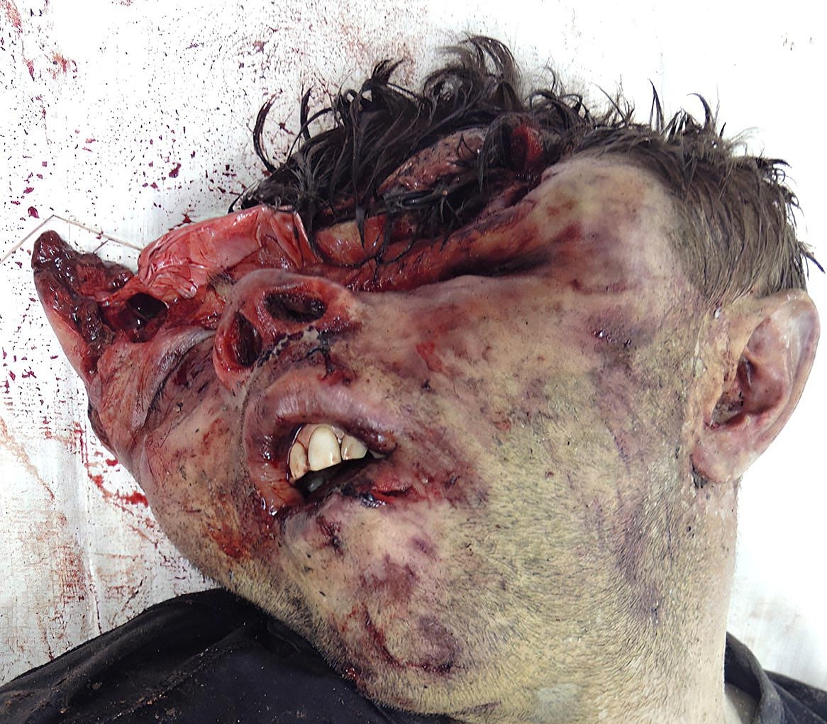 Death, Illness, Injury, Healing #1