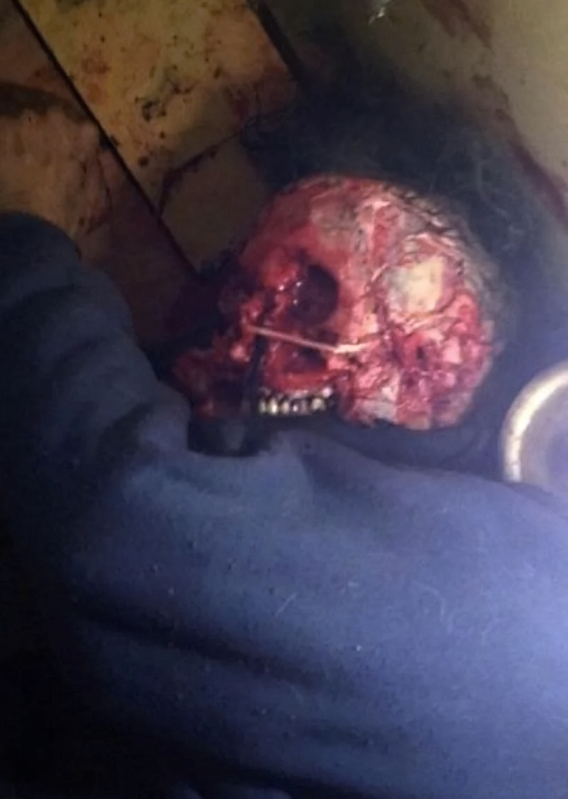 Death, Illness, Injury, Healing #1