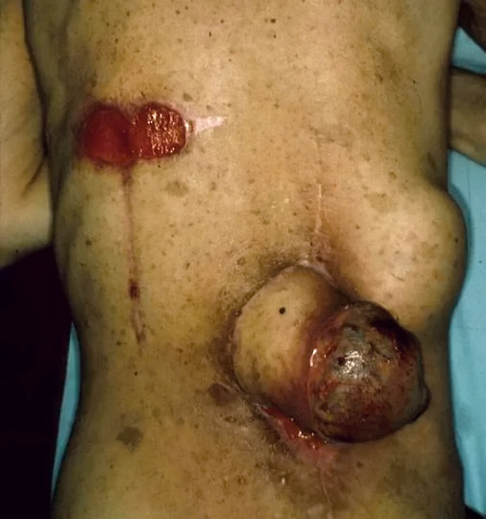 Death, Illness, Injury, Healing #1