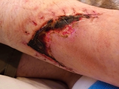 Death, Illness, Injury, Healing #1