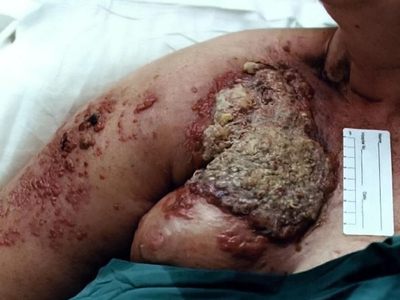 Death, Illness, Injury, Healing #1