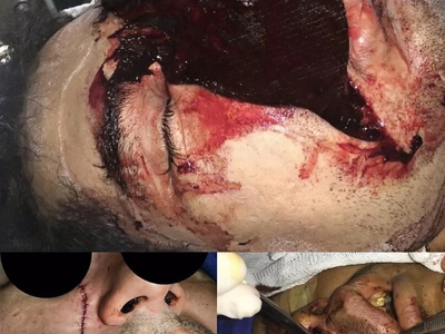 Death, Illness, Injury, Healing #1