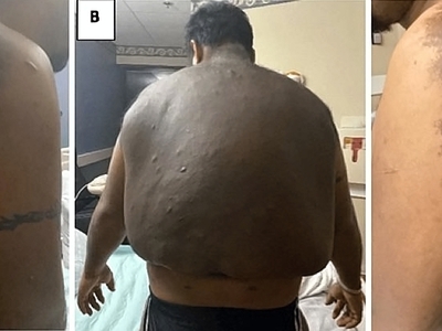 Death, Illness, Injury, Healing #1