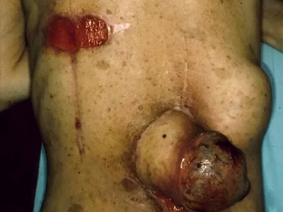 Death, Illness, Injury, Healing #1