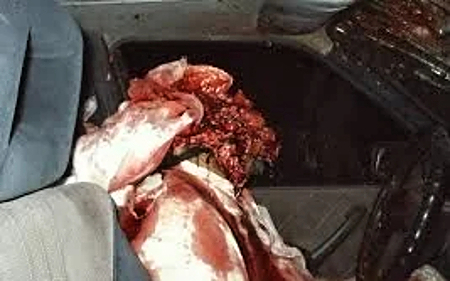 Compilation of shotgun wounds