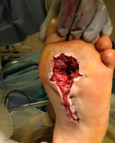 Compilation of shotgun wounds