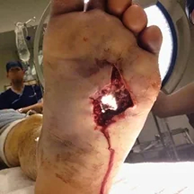 Compilation of shotgun wounds