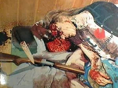 Compilation of shotgun wounds