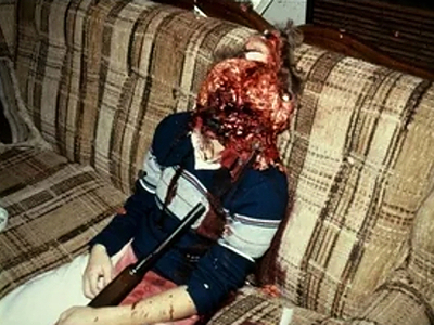 Compilation of shotgun wounds