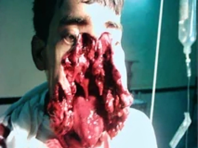 Compilation of shotgun wounds